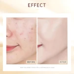 Antes y después de mascarilla nocturna con oro y niacinamida, mostrando reducción de arrugas y mejora en la piel.