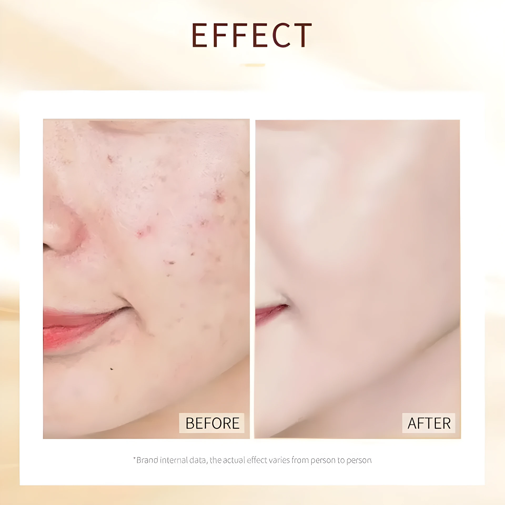 Antes y después de mascarilla nocturna con oro y niacinamida, mostrando reducción de arrugas y mejora en la piel.