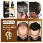 Serum Ganoderma Covergray: antes/después canas oscurecidas y antes/después calvicie mejorada. Disfruta efecto multivitamínico.