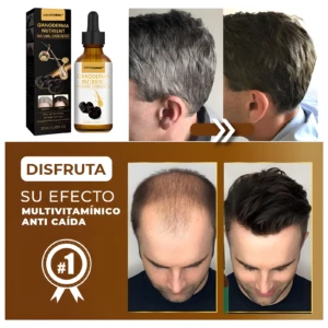 Serum Ganoderma Covergray: antes/después canas oscurecidas y antes/después calvicie mejorada. Disfruta efecto multivitamínico.