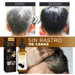 Serum Covergray Ganoderma Nutriente para oscurecer canas. Antes y después de tratamiento. Frasco gotero de 30ml.