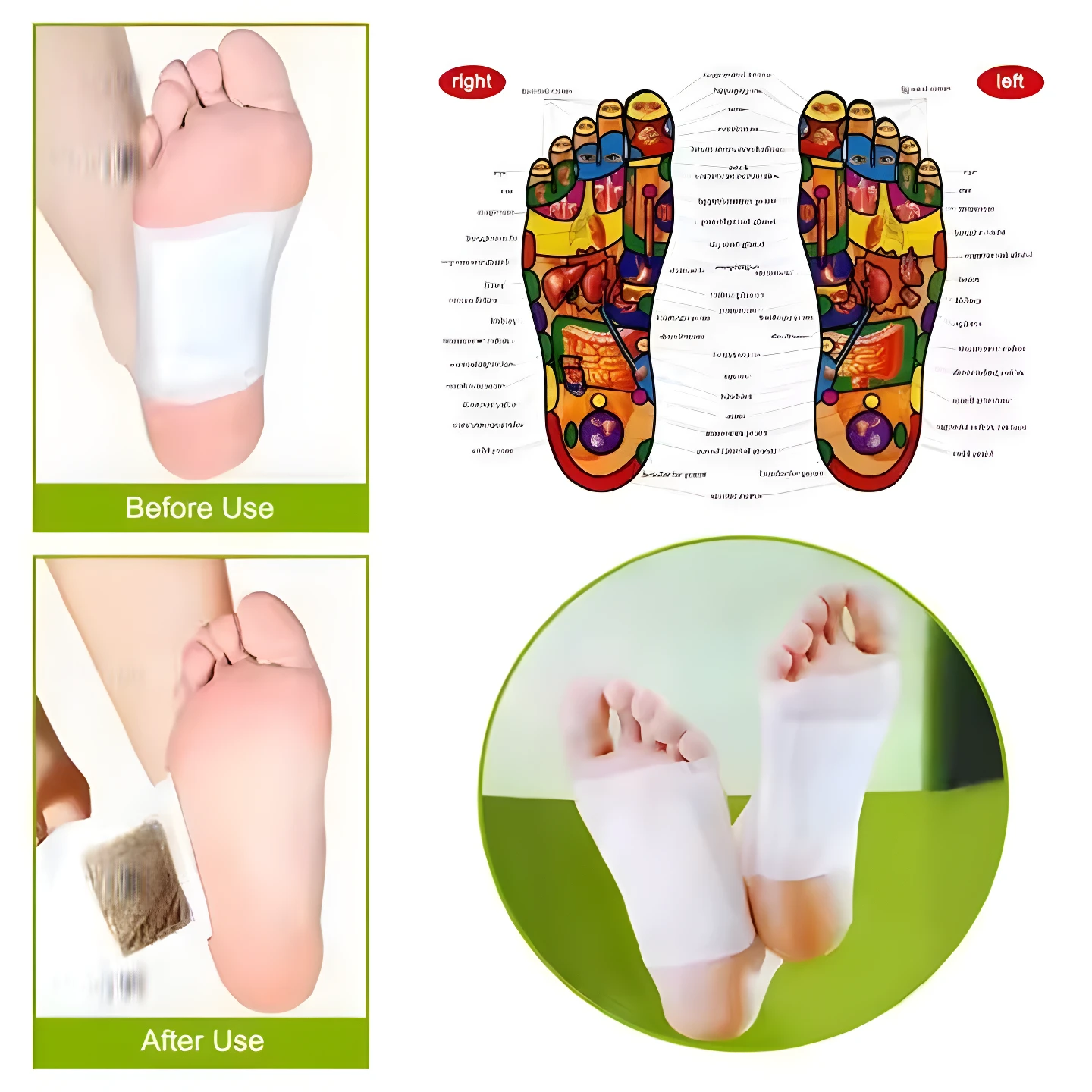 Pies con parches Kinoki para desintoxicar, antes y después de su uso, y mapa de reflexología podal.