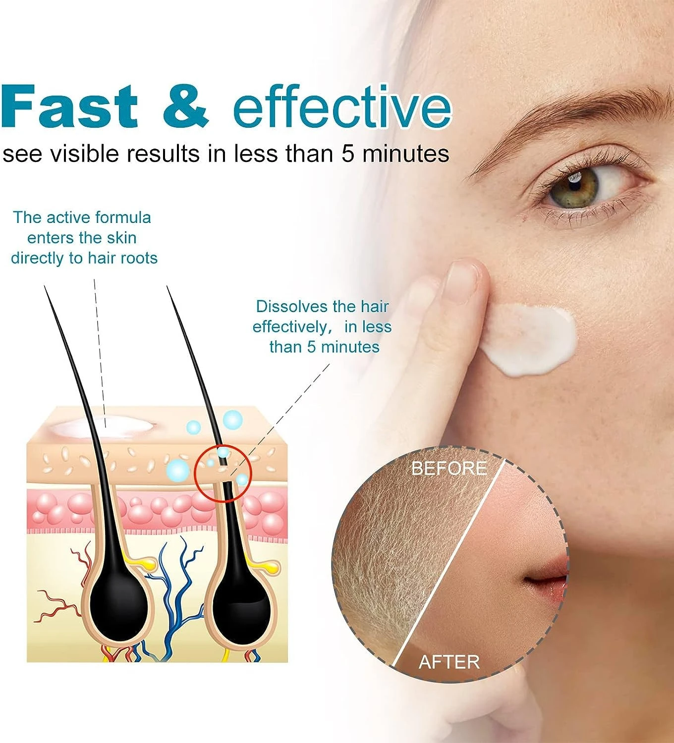 Crema depilatoria Eelohe que disuelve el vello en 5 minutos. Antes y después.