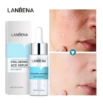 Serum Lanbena Ácido Hialurónico 15ml, caja y gotero, mejora piel con imperfecciones.