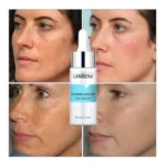 Serum Lanbena Ácido Hialurónico: antes y después en piel con manchas, mejora hidratación. Incluye frasco 15ml.