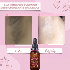 Tónico LB despigmentante de 30 ml con resultados visibles antes y después en el aclarado de manchas oscuras en la piel de las axilas.