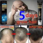 Crema para el crecimiento capilar, muestra antes y después, con un hombre calvo aplicándose el producto.