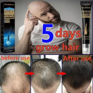 Crema para el crecimiento capilar, muestra antes y después, con un hombre calvo aplicándose el producto.