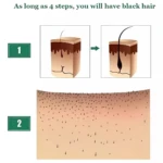 Diagrama de crecimiento capilar con tónico de jengibre en 4 pasos. Muestra cabello débil y luego fortalecido.