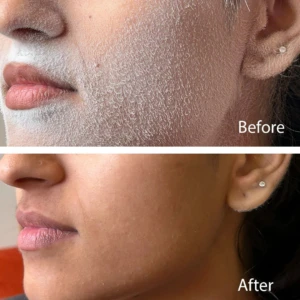 Primer plano de cara con spray identificador de cabello aplicado antes y después, mostrando piel limpia.