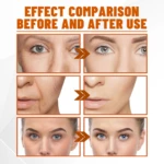 Comparación antes y después de mascarilla de colágeno y vitamina C, mostrando reducción de arrugas y mejora de la piel.