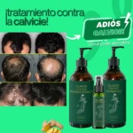 Tratamiento anticaída Ouhoe: shampoo, acondicionador y spray con jengibre. Comparativa de antes y después.