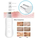 Limpiador facial ultrasónico blanco con 3 modos, elimina puntos negros y limpia poros, comparativa antes y después.