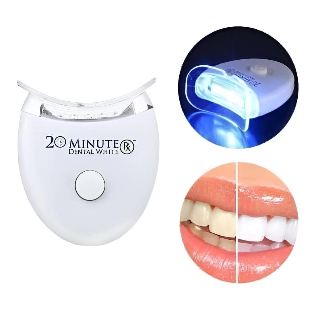 Kit de blanqueamiento dental con dispositivo de luz LED blanca, boquilla transparente y comparativa visual de dientes antes y después del tratamiento.