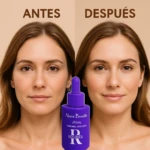 Set x2 Serum Retinol Alma Beuaty, antes y después, rostro con mejoras notables en piel.