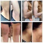 Barra exfoliante aclarante Epoch con barro marino, antes y después en axilas, brazos, rodillas y cuello.