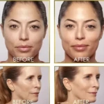 Set x2 depilador facial eléctrico Dermaplane con luz LED, antes y después, rostro mujer y perfil.