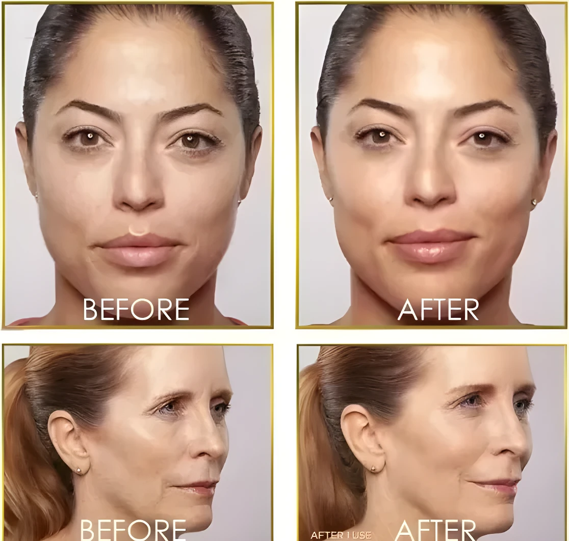 Set x2 depilador facial eléctrico Dermaplane con luz LED, antes y después, rostro mujer y perfil.