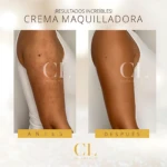 Antes y después de brazos con crema bronceadora que unifica tono y disimula imperfecciones.