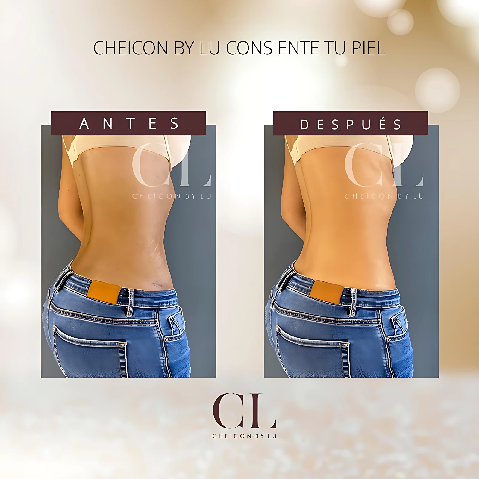 Crema corporal bronceadora "Antes y después" que unifica tono y disimula estrías.