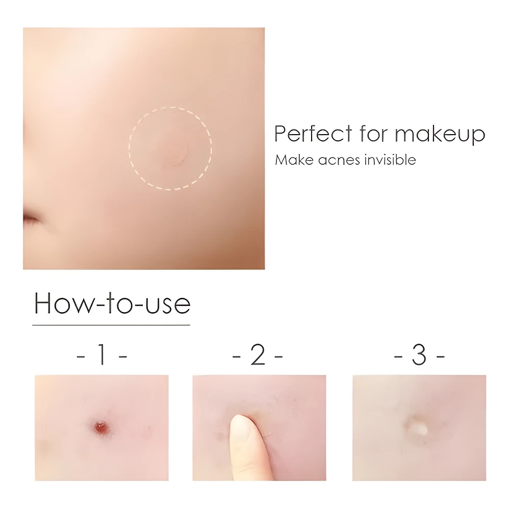 Extractores de espinillas para maquillaje y uso con herida, paso a paso.