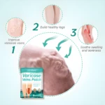 Parches para varices SEFUDUN, muestra mejora, piernas sanas y alivio de dolor. Incluye 8 parches.