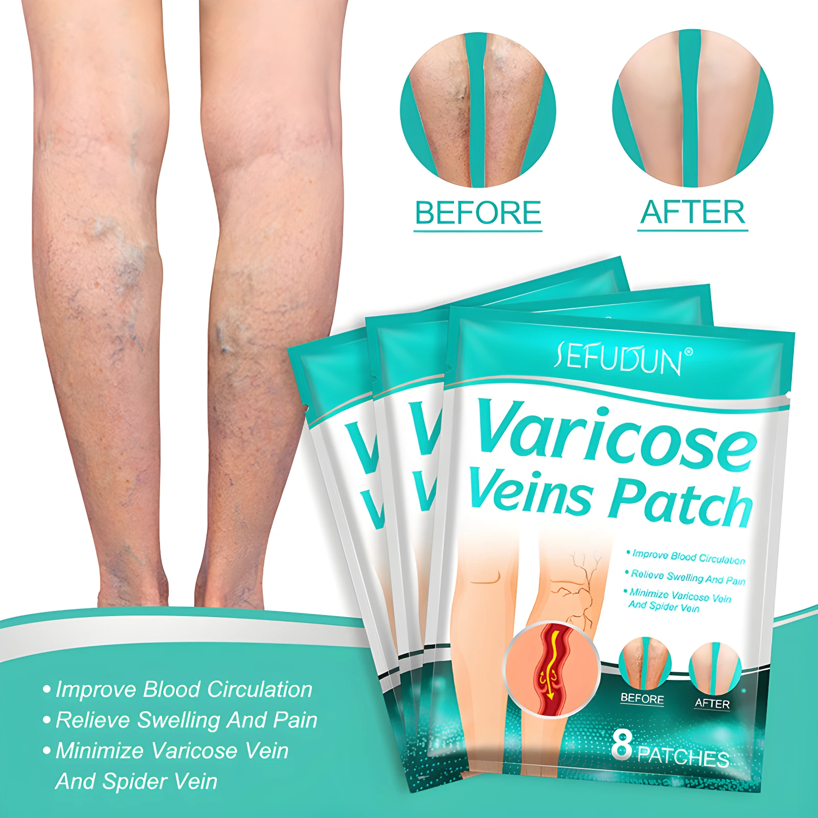 Parches para varices SEFUDUN, mejora circulación y alivia dolor, antes y después, 8 parches.
