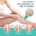Set x2 parches tratamiento varices, mejora visible en piernas tras 15, 30 y 60 días de uso.