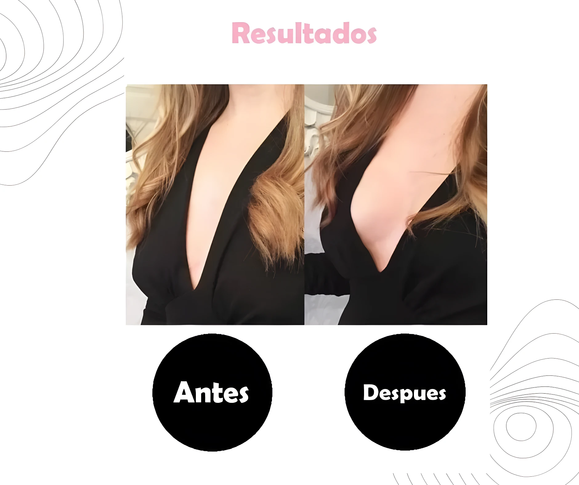 Antes y después de usar pezoneras invisibles Realsa, mostrando soporte y realce.