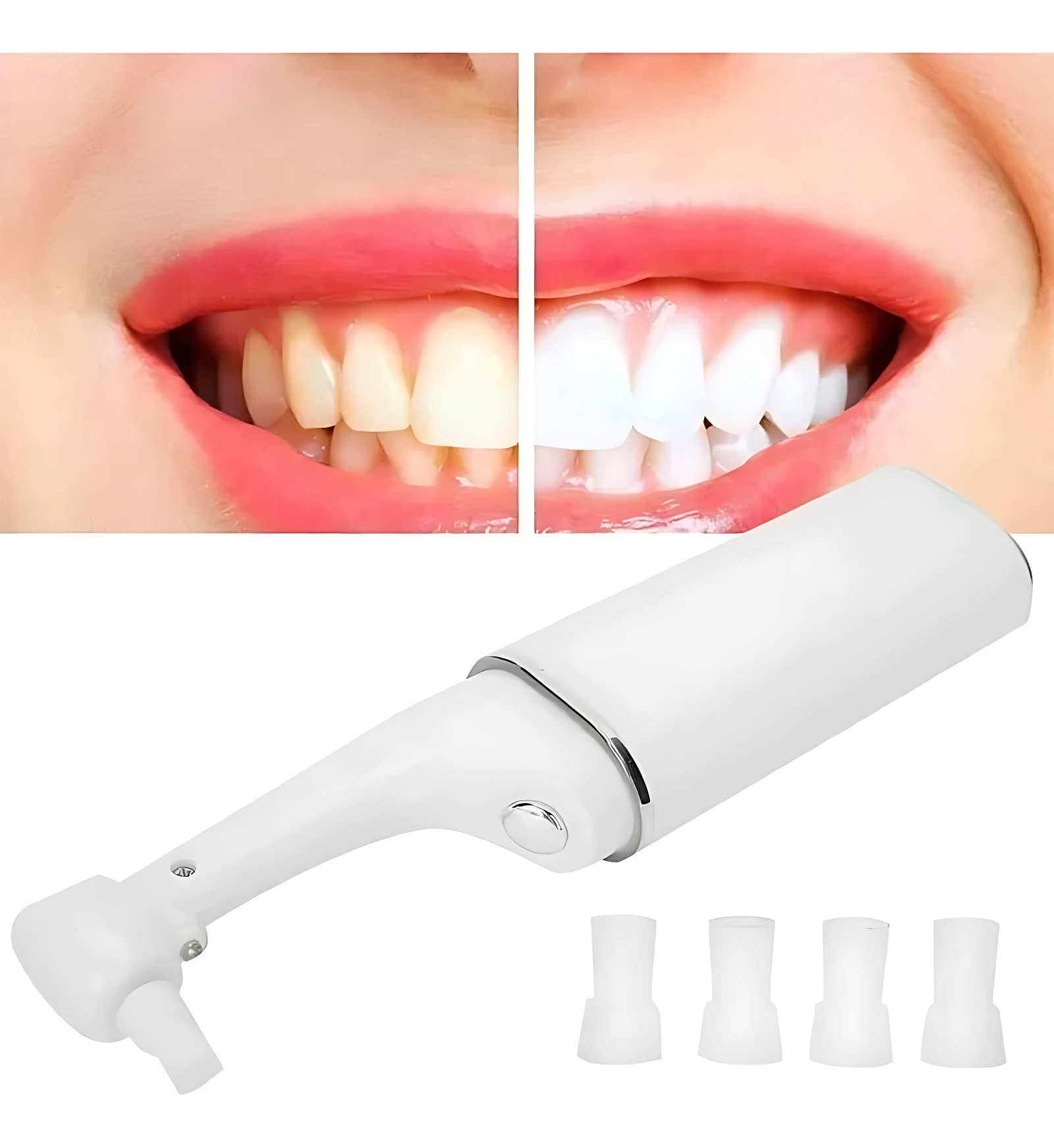 Pulidor dental portátil blanco, ideal para una sonrisa más blanca y pulida. Incluye 4 puntas.