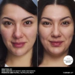 Comparativa de rostro antes y después de usar The INKEY List Retinol Antiedad: piel más lisa y uniforme.