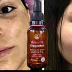 Tónico aclarante despigmentante LB en frasco ámbar, 30 ml aprox., para reducir manchas en la piel.