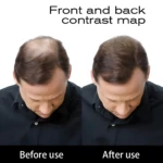 Comparativa de un hombre antes y después de aplicar fibras capilares Toppik color negro, mostrando mayor densidad y cobertura en la zona superior.