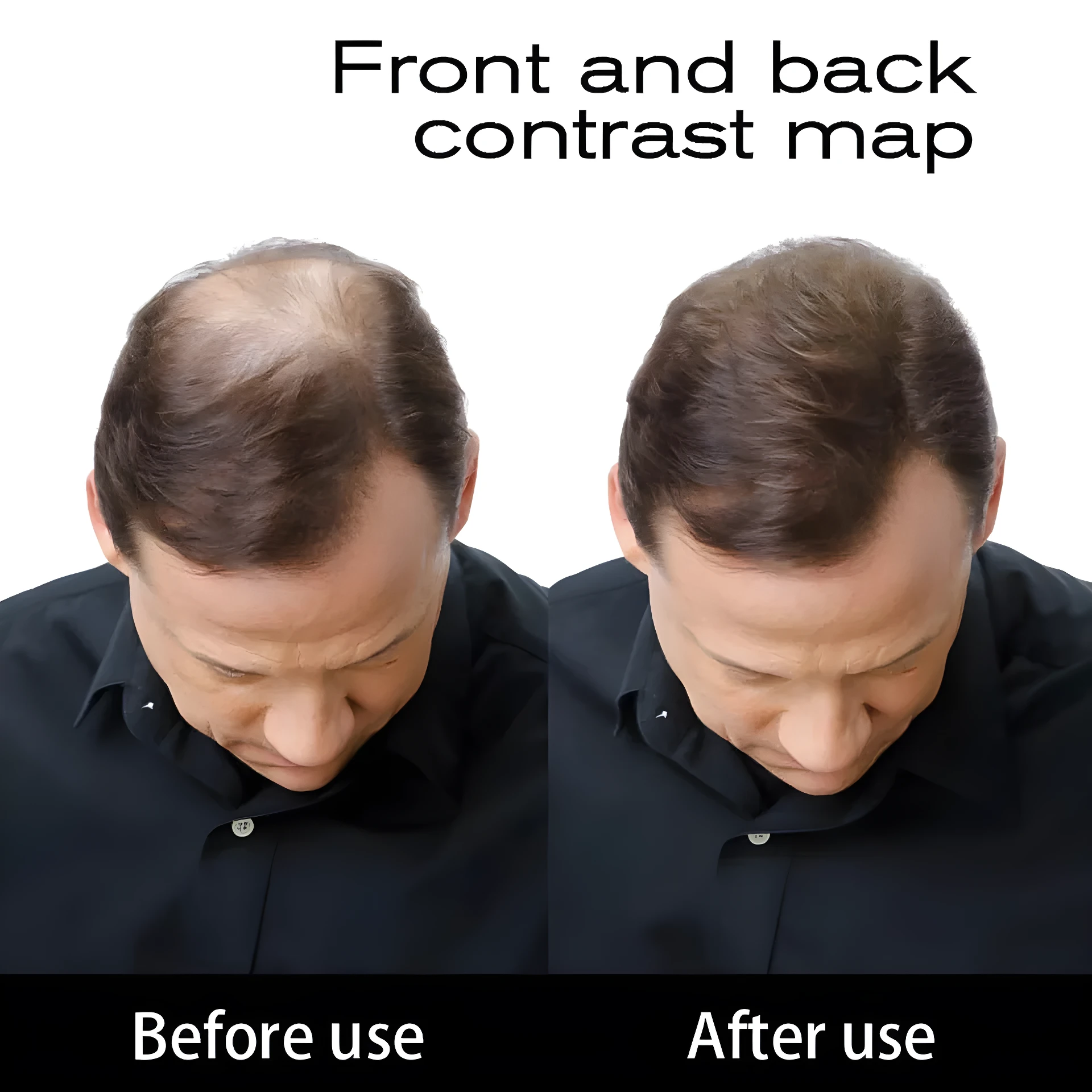 Comparativa de un hombre antes y después de aplicar fibras capilares Toppik color negro, mostrando mayor densidad y cobertura en la zona superior.