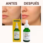 Set x3 Sérum Rejuvenecedor Kormesic con 30% AHA - Renueva y ilumina tu piel noche a noche