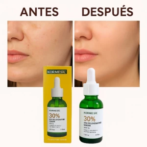 Sérum Kormesic 30% AHA antes y después, piel renovada e iluminada. Presentación de 30ml y 50ml.