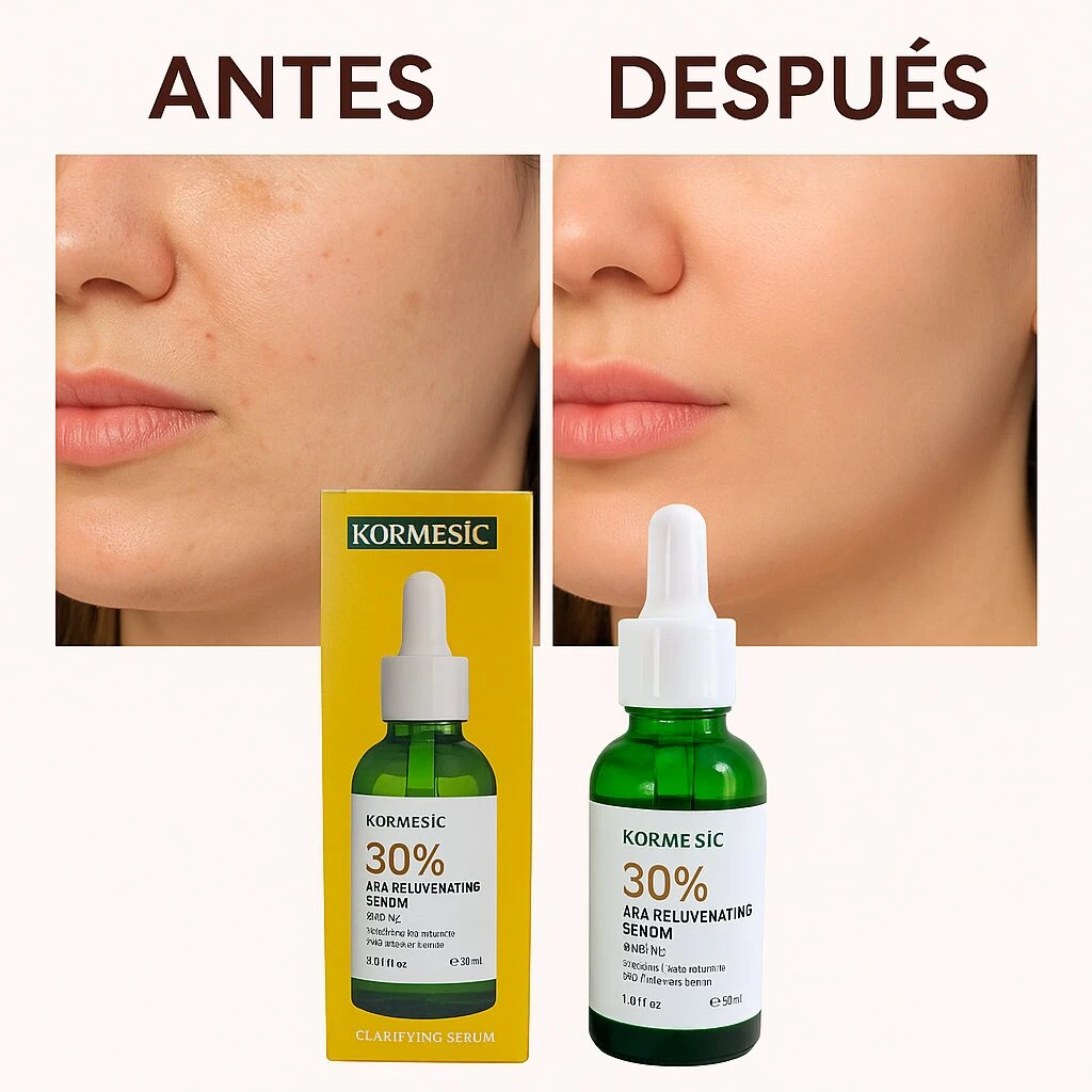 Set x3 Sérum Rejuvenecedor Kormesic con 30% AHA - Renueva y ilumina tu piel noche a noche