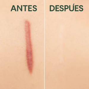 Gel Hidratante con Extracto de Aloe Vera