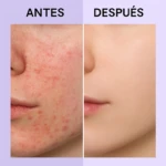Set x3 Serum Semilla de Camelia con Centella - Imagen 2