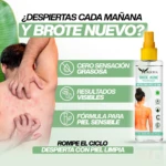 Back Acne-Acne Corporal - Imagen 3