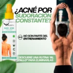 Back Acne-Acne Corporal - Imagen 5