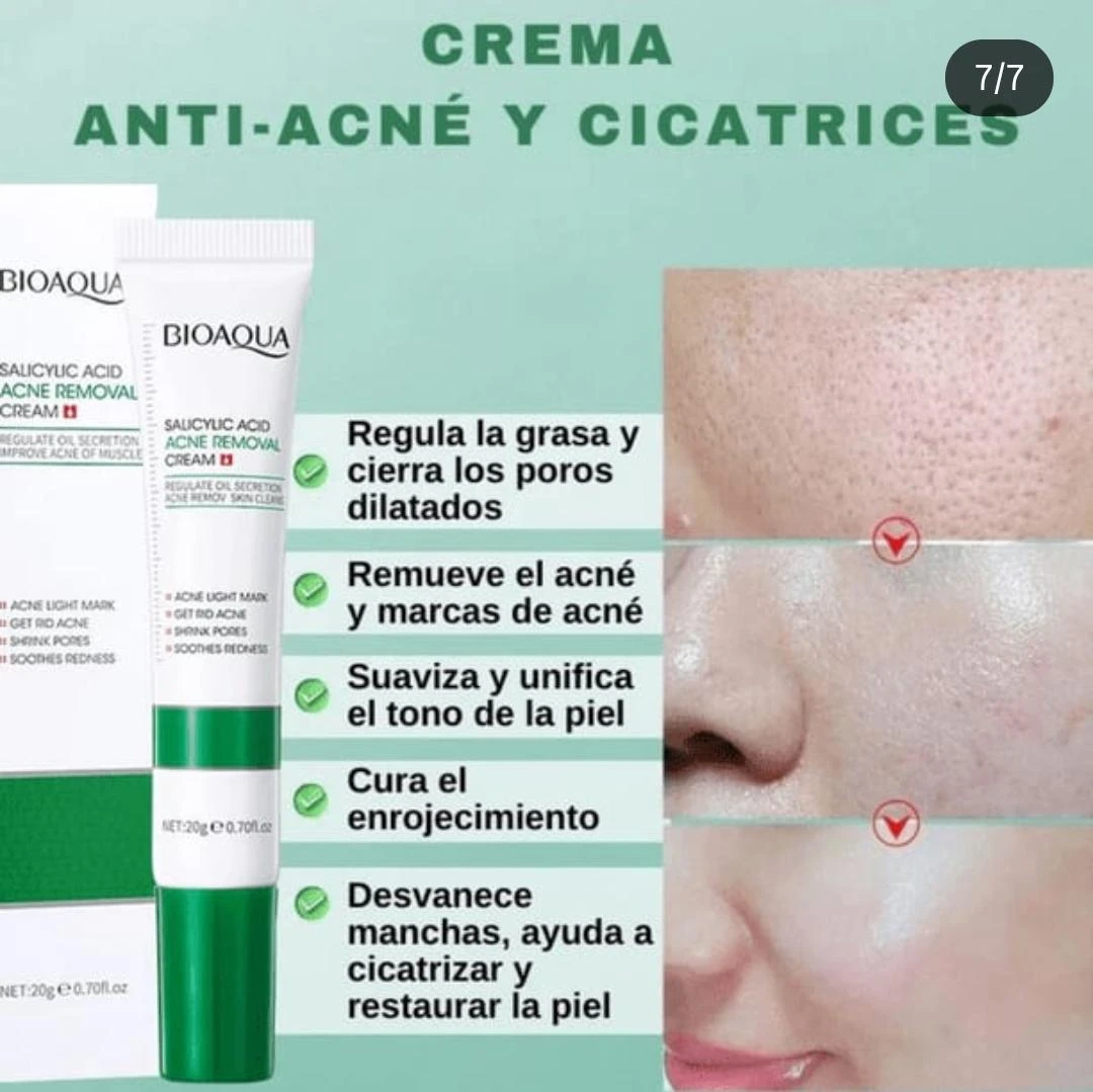 Set x2 crema anti acné BIOAQUA, elimina granos y cicatrices, unifica tono de piel.