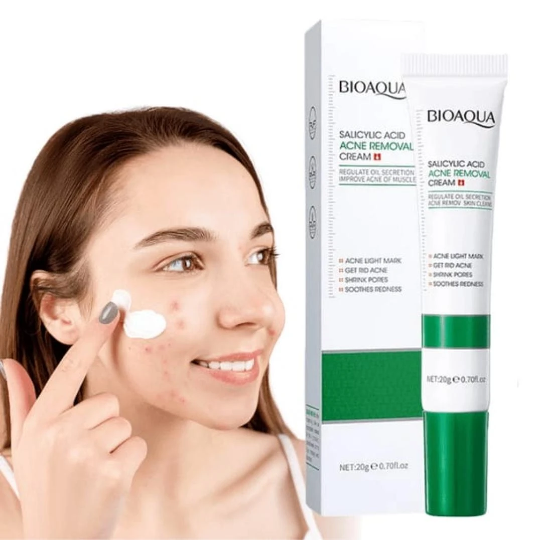 Mujer aplica crema anti acné BIOAQUA en su rostro con granos. Caja y tubo de crema de 20g.