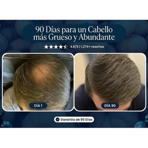 Cabello antes y después de 90 días de uso de Excalvo Shampoo Anti-Caída, mostrando mayor densidad y volumen.