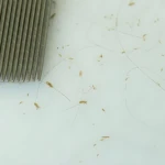 Peine de acero inoxidable con varios piojos y liendres capturados, para eliminación eficaz.