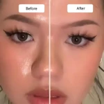 Comparativa de piel antes y después del uso del rodillo volcánico facial, mostrando reducción de brillo y grasa en la zona T.