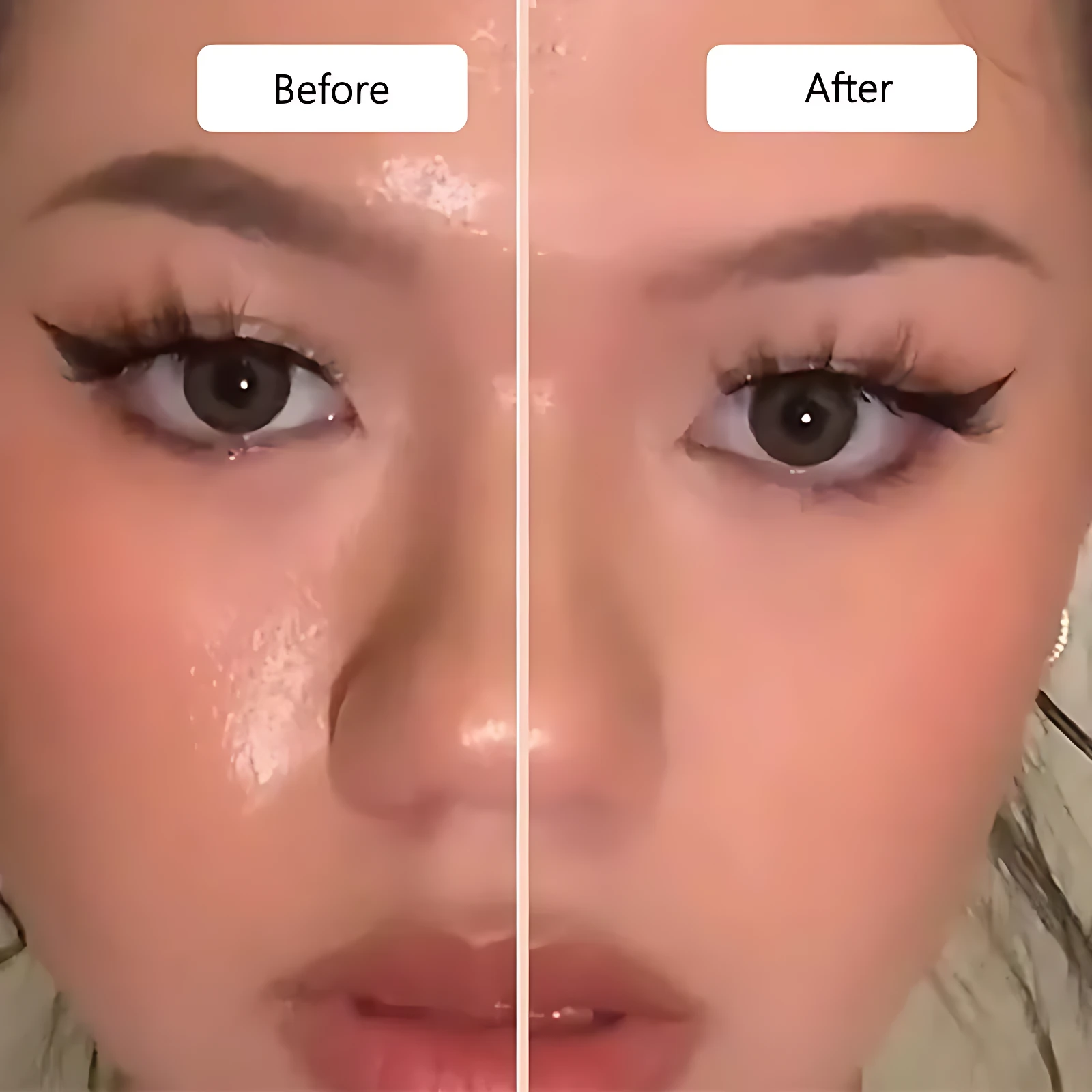 Comparativa de piel antes y después del uso del rodillo volcánico facial, mostrando reducción de brillo y grasa en la zona T.