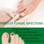 Aceite de Jengibre para Uñas - Imagen 2