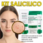 Kit de cuidado facial con limpiador, mascarilla y tratamiento para piel grasa. Incluye crema, tubos y envase verde. Muestra textura de producto y rostro con granos. Texto en español neutro de Colombia.