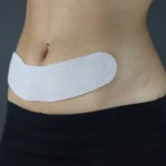 Lamina en Gel Post-Cirugia de Abdomen - Imagen 2